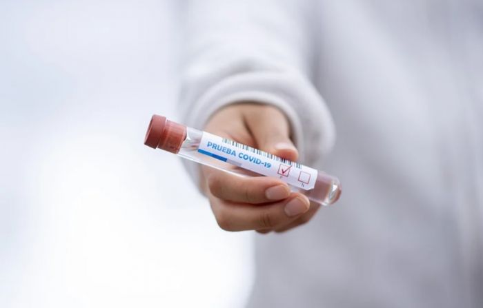 В ХМАО за сутки выявлено менее 300 новых заболевших коронавирусом