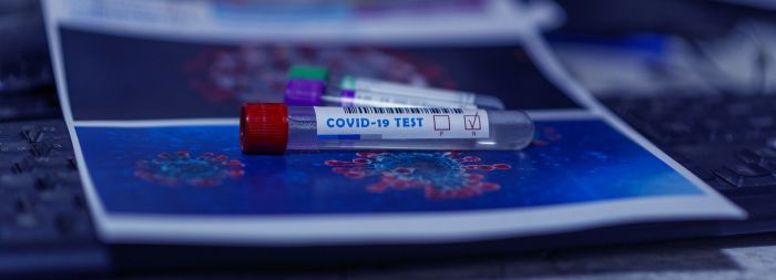 Число зараженных омикроном в Югре увеличилось