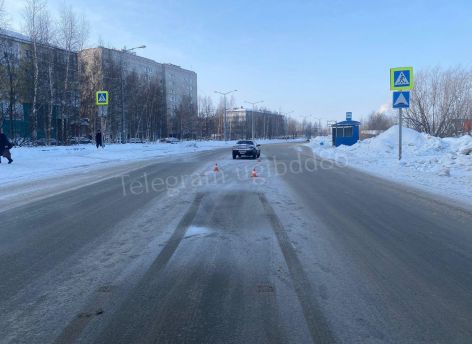Пожилая вартовчанка попала под колеса легковушки