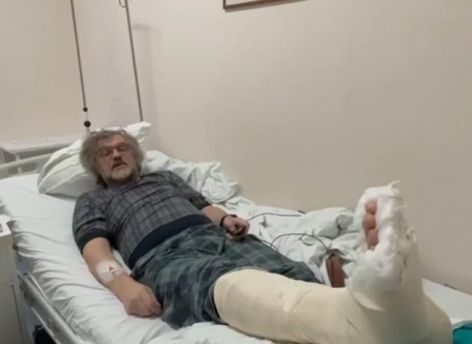 ​Эмир Кустурица не приедет на открытие «Духа огня» из-за перелома ноги