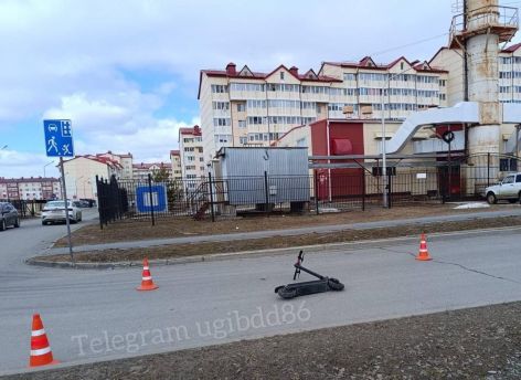 В Югорске женщина перевернулась на мощном электросамокате – она была без прав и отказалась от медосвидетельствования
